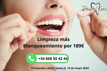 Blanqueamiento dental precio dental ever alcobendas