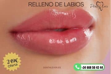 relleno de labios acido hialuronico dental ever